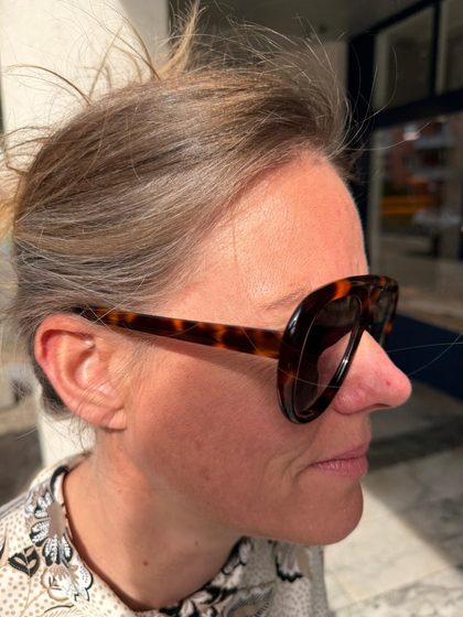 Reales Foto am Gesicht — Profil (Quelle)